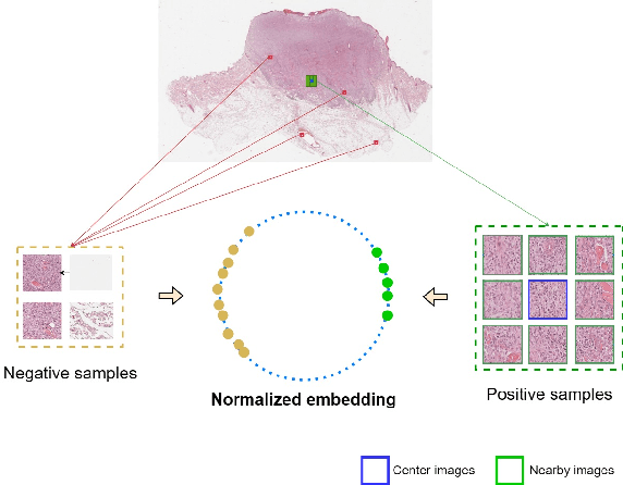 Figure 3 for NearbyPatchCL: Leveraging Nearby Patches for Self-Supervised Patch-Level Multi-Class Classification in Whole-Slide Images