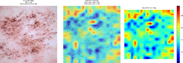 Figure 4 for The Skin Game: Revolutionizing Standards for AI Dermatology Model Comparison