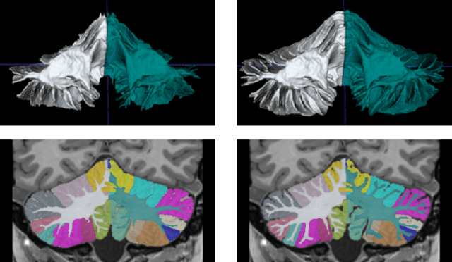 Figure 2 for DeepCERES: A Deep learning method for cerebellar lobule segmentation using ultra-high resolution multimodal MRI