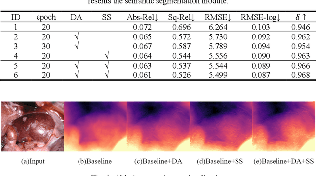 Figure 4 for Occlusion-Aware Self-Supervised Monocular Depth Estimation for Weak-Texture Endoscopic Images