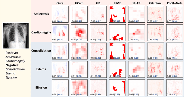 Figure 4 for Inherently Interpretable Multi-Label Classification Using Class-Specific Counterfactuals