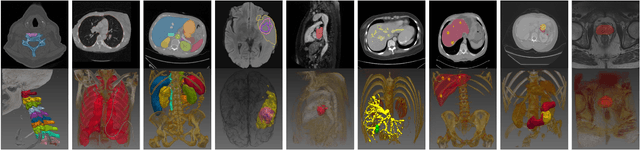 Figure 3 for Medical Image Segmentation Review: The success of U-Net