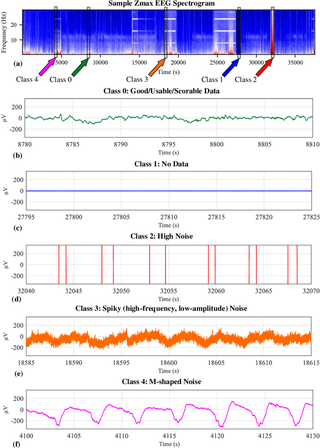 Figure 4 for eegFloss: A Python package for refining sleep EEG recordings using machine learning models
