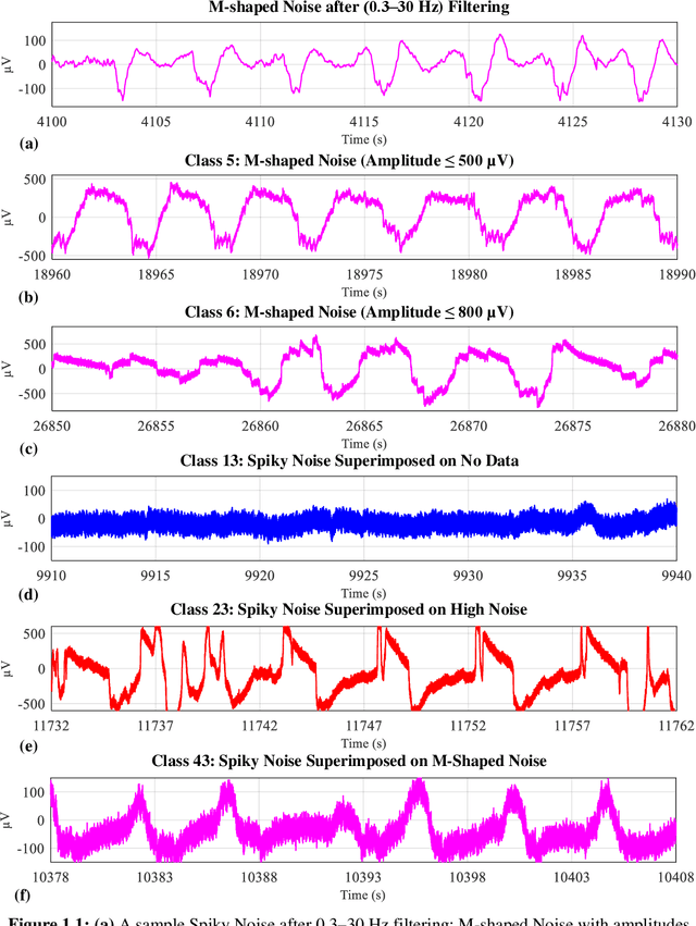 Figure 3 for eegFloss: A Python package for refining sleep EEG recordings using machine learning models