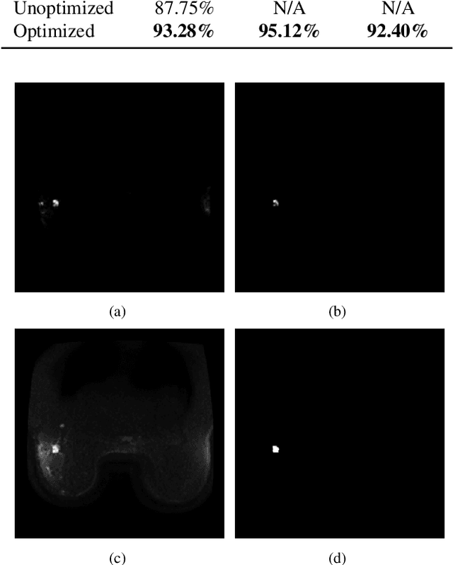 Figure 2 for Using Multiparametric MRI with Optimized Synthetic Correlated Diffusion Imaging to Enhance Breast Cancer Pathologic Complete Response Prediction