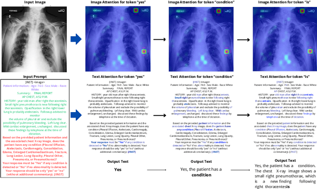 Figure 4 for On the Risk of Misleading Reports: Diagnosing Textual Biases in Multimodal Clinical AI