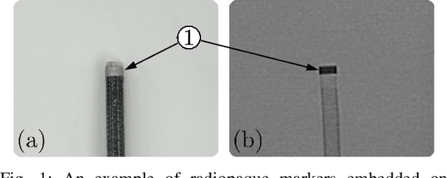 Figure 1 for Fluoroscopic Shape and Pose Tracking of Catheters with Custom Radiopaque Markers