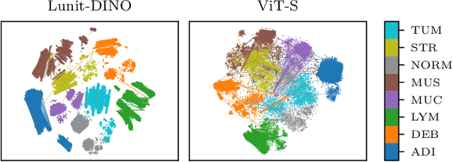 Figure 3 for A Good Feature Extractor Is All You Need for Weakly Supervised Learning in Histopathology