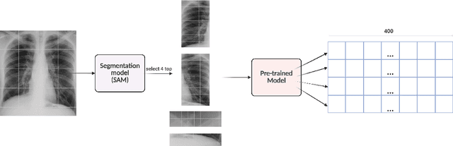 Figure 3 for MedVQA-TREE: A Multimodal Reasoning and Retrieval Framework for Sarcopenia Prediction