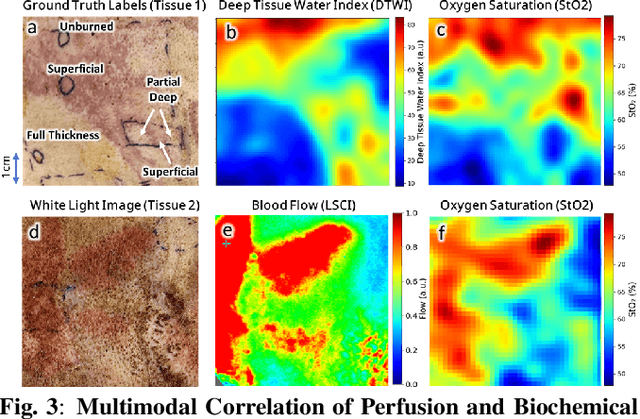 Figure 3 for Multimodal Optical Imaging Platform for Quantitative Burn Assessment