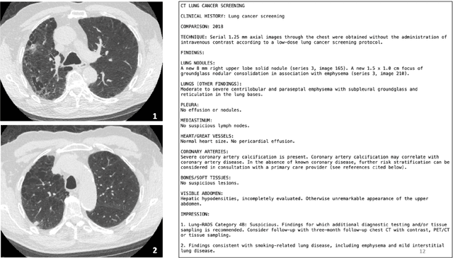 Figure 3 for Are Generative AI systems Capable of Supporting Information Needs of Patients?