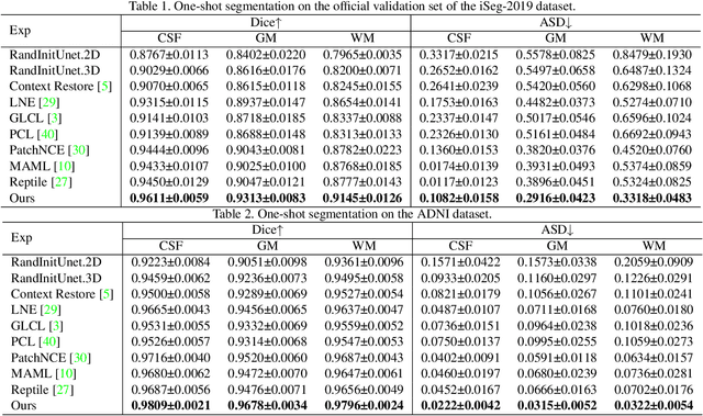 Figure 2 for Dual Meta-Learning with Longitudinally Generalized Regularization for One-Shot Brain Tissue Segmentation Across the Human Lifespan