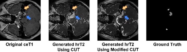 Figure 3 for MS-MT: Multi-Scale Mean Teacher with Contrastive Unpaired Translation for Cross-Modality Vestibular Schwannoma and Cochlea Segmentation