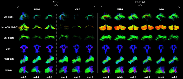Figure 3 for Cross-Population White Matter Atlas Creation for Concurrent Mapping of Brain Connections in Neonates and Adults with Diffusion MRI Tractography