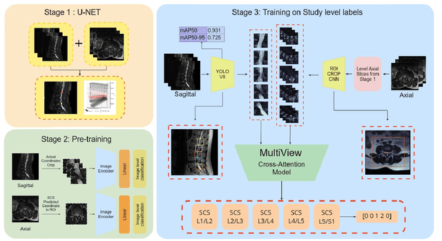 Figure 2 for M-SCAN: A Multistage Framework for Lumbar Spinal Canal Stenosis Grading Using Multi-View Cross Attention