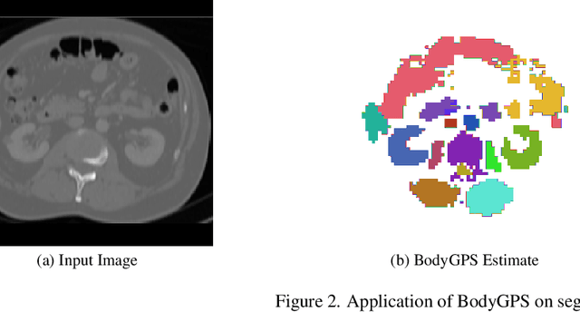 Figure 3 for BodyGPS: Anatomical Positioning System