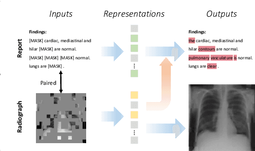 Figure 1 for Advancing Radiograph Representation Learning with Masked Record Modeling