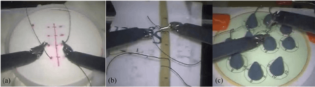 Figure 3 for Enhancing Precision in Tactile Internet-Enabled Remote Robotic Surgery: Kalman Filter Approach