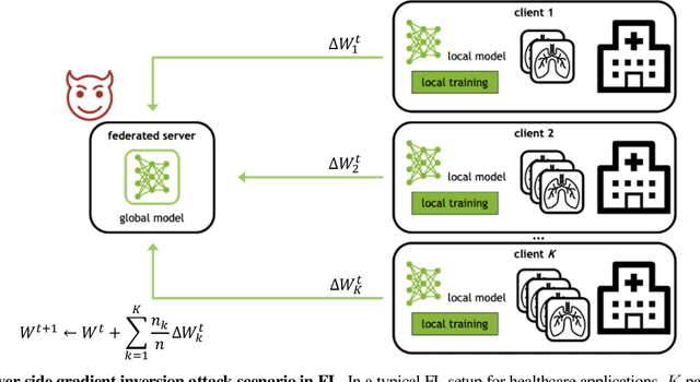 Figure 1 for Do Gradient Inversion Attacks Make Federated Learning Unsafe?