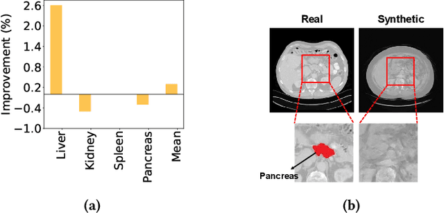 Figure 1 for Devil is in Details: Locality-Aware 3D Abdominal CT Volume Generation for Self-Supervised Organ Segmentation
