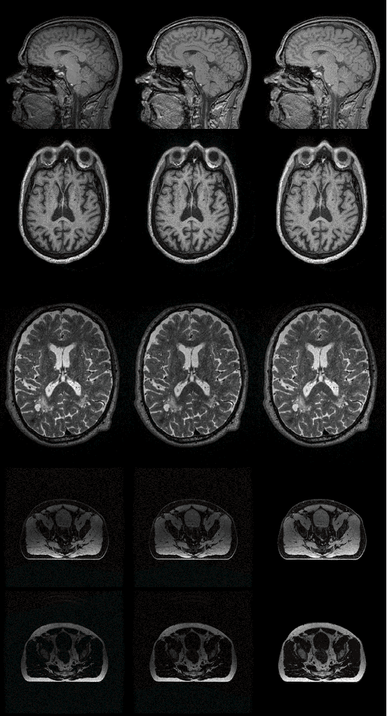 Figure 3 for Zero-shot Bias Correction: Efficient MR Image Inhomogeneity Reduction Without Any Data