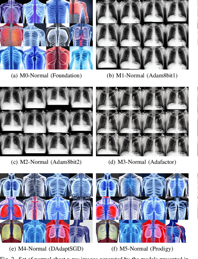 Figure 2 for Exploring Foundation Models for Synthetic Medical Imaging: A Study on Chest X-Rays and Fine-Tuning Techniques