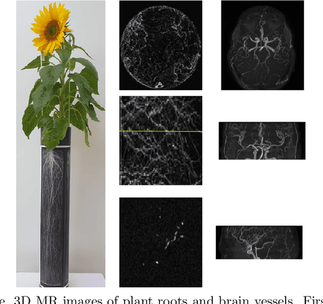Figure 1 for Untrained Perceptual Loss for image denoising of line-like structures in MR images