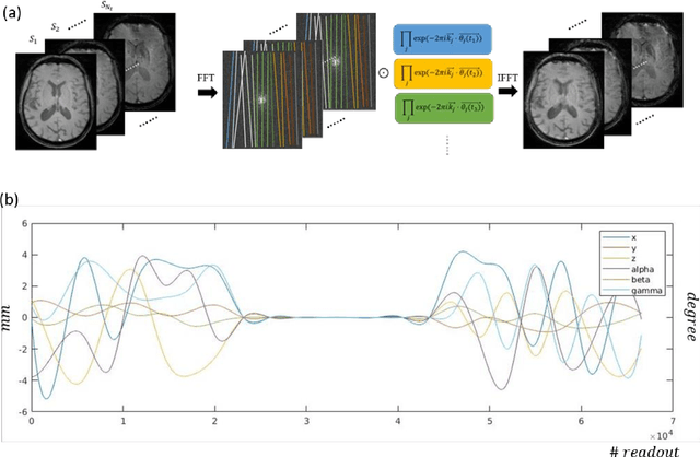 Figure 1 for Deep learning improved autofocus for motion artifact reduction and its application in quantitative susceptibility mapping