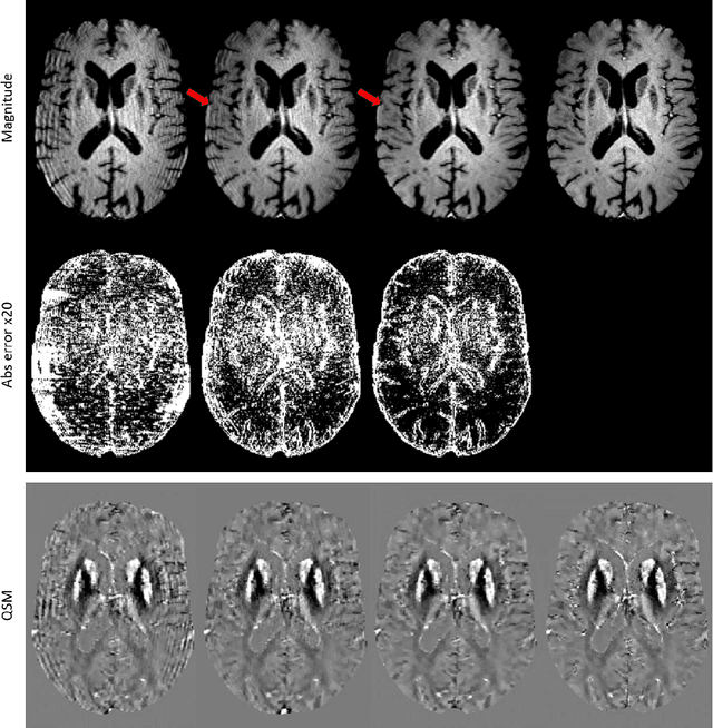 Figure 2 for Deep learning improved autofocus for motion artifact reduction and its application in quantitative susceptibility mapping