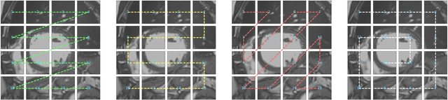 Figure 3 for MHS-VM: Multi-Head Scanning in Parallel Subspaces for Vision Mamba