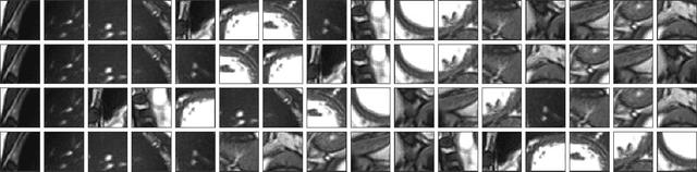 Figure 4 for MHS-VM: Multi-Head Scanning in Parallel Subspaces for Vision Mamba