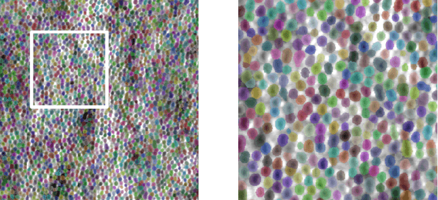 Figure 4 for Automated Segmentation and Analysis of Cone Photoreceptors in Multimodal Adaptive Optics Imaging