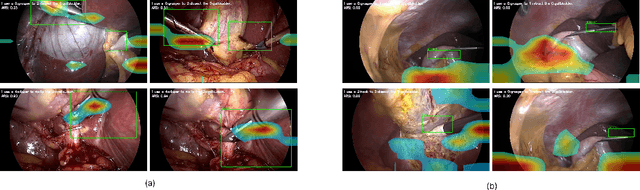 Figure 3 for Benchmarking performance, explainability, and evaluation strategies of vision-language models for surgery: Challenges and opportunities