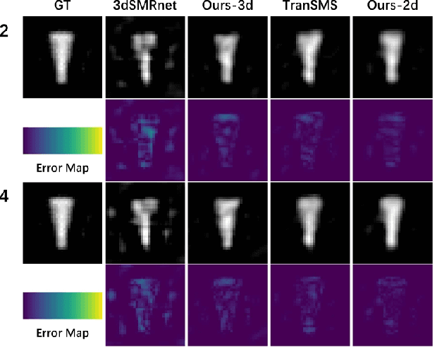 Figure 4 for Position-Prior-Guided Network for System Matrix Super-Resolution in Magnetic Particle Imaging