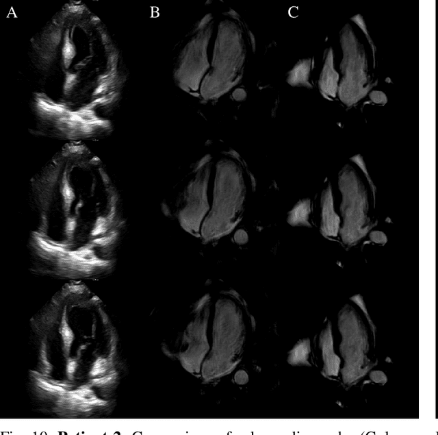 Figure 2 for Echocardiography to Cardiac MRI View Transformation for Real-Time Blind Restoration