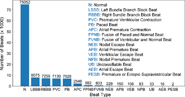 Figure 1 for Resource-Efficient Heartbeat Classification Using Multi-Feature Fusion and Bidirectional LSTM