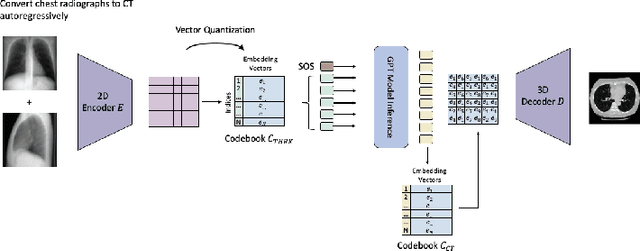 Figure 3 for Transformers for CT Reconstruction From Monoplanar and Biplanar Radiographs