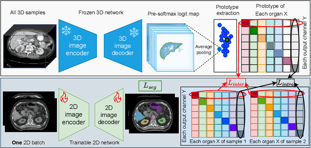 Figure 3 for Enhancing Single-Slice Segmentation with 3D-to-2D Unpaired Scan Distillation