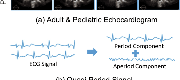 Figure 1 for Q-PART: Quasi-Periodic Adaptive Regression with Test-time Training for Pediatric Left Ventricular Ejection Fraction Regression