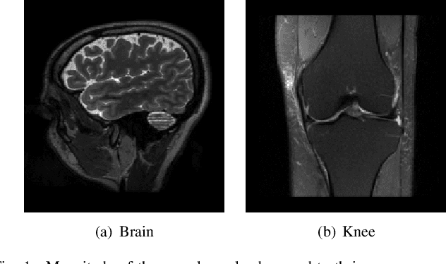 Figure 1 for Convergent Complex Quasi-Newton Proximal Methods for Gradient-Driven Denoisers in Compressed Sensing MRI Reconstruction