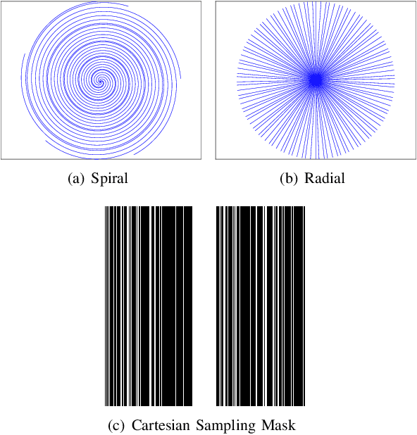 Figure 2 for Convergent Complex Quasi-Newton Proximal Methods for Gradient-Driven Denoisers in Compressed Sensing MRI Reconstruction