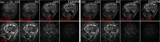 Figure 4 for Convergent Complex Quasi-Newton Proximal Methods for Gradient-Driven Denoisers in Compressed Sensing MRI Reconstruction