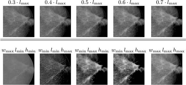 Figure 2 for StyleX: A Trainable Metric for X-ray Style Distances
