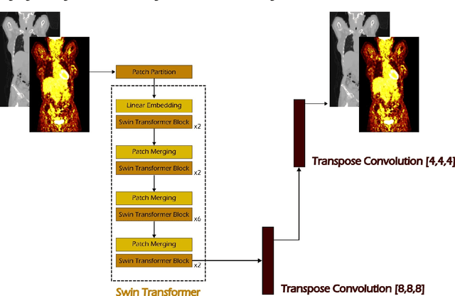 Figure 3 for Anatomy-Aware Lymphoma Lesion Detection in Whole-Body PET/CT