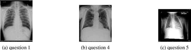 Figure 4 for Fusion of Domain-Adapted Vision and Language Models for Medical Visual Question Answering