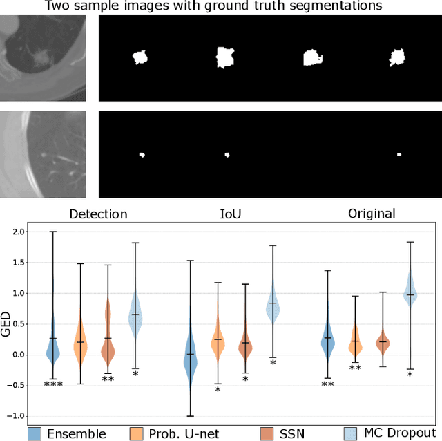 Figure 4 for Navigating Uncertainty in Medical Image Segmentation