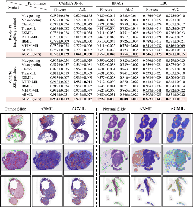 Figure 2 for Attention-Challenging Multiple Instance Learning for Whole Slide Image Classification
