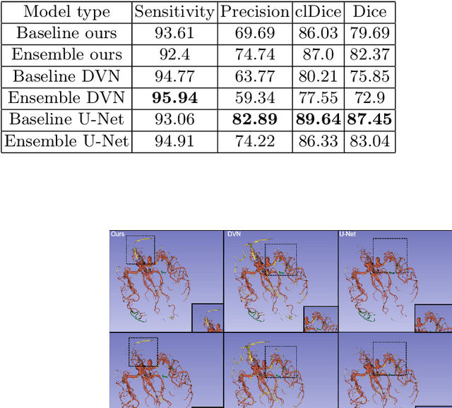 Figure 3 for Efficient Epistemic Uncertainty Estimation in Cerebrovascular Segmentation