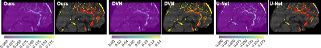 Figure 4 for Efficient Epistemic Uncertainty Estimation in Cerebrovascular Segmentation