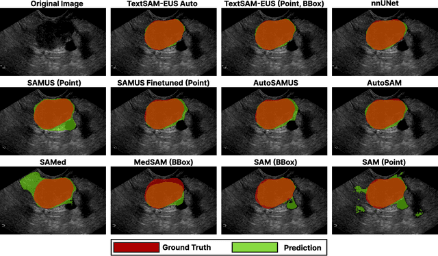 Figure 4 for TextSAM-EUS: Text Prompt Learning for SAM to Accurately Segment Pancreatic Tumor in Endoscopic Ultrasound